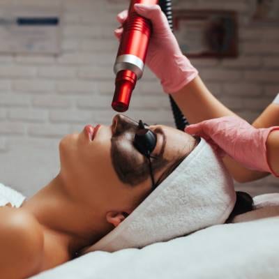 Carbon Facial